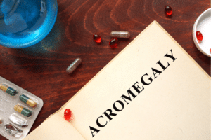 malattia acromegalia